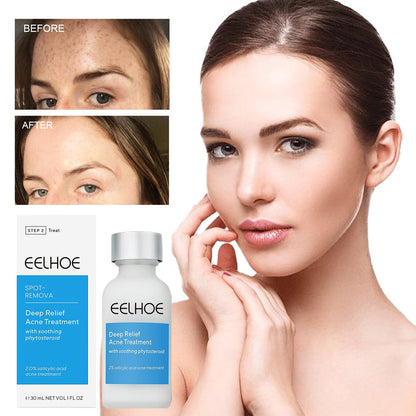 EELHOE™ Dark Spot and Acne Treatment Lotion