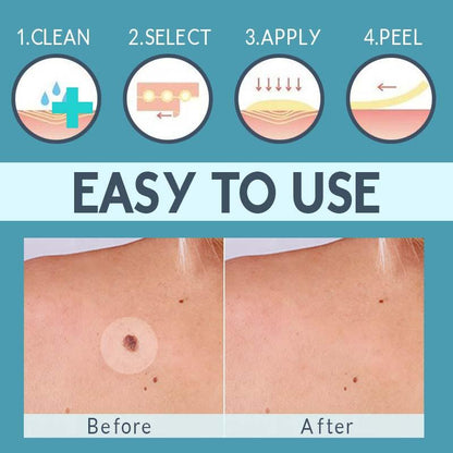 Skin Tag Remover Patch™