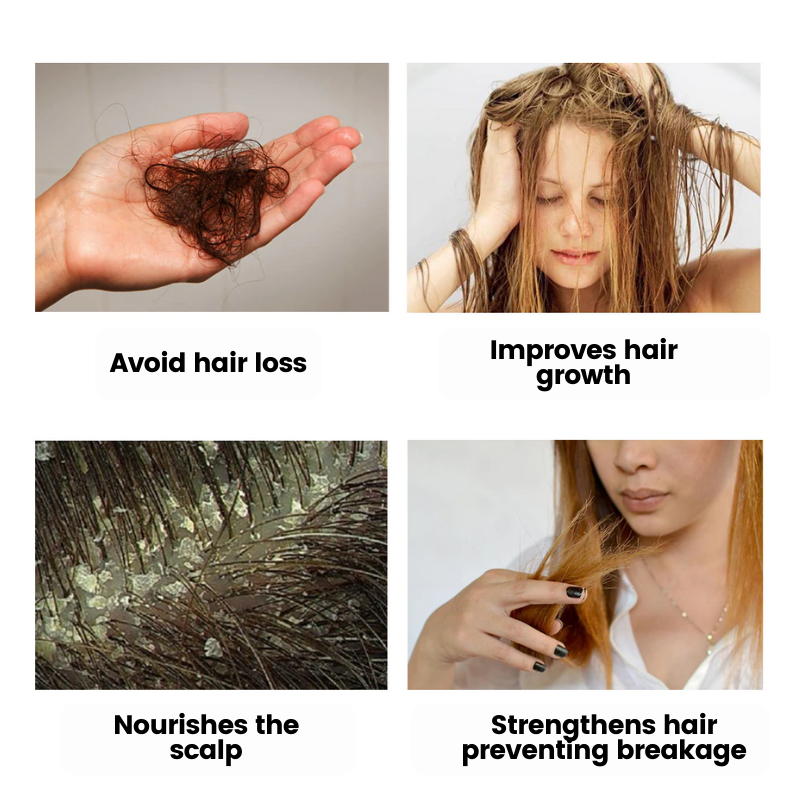 Aceite esencial para el crecimiento del cabello™