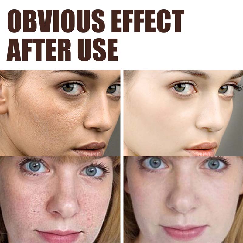 Retinol Anti Aging Face Cream