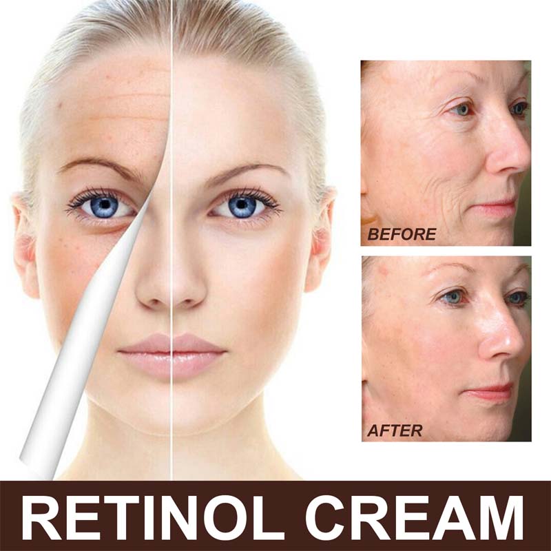Retinol Anti Aging Face Cream
