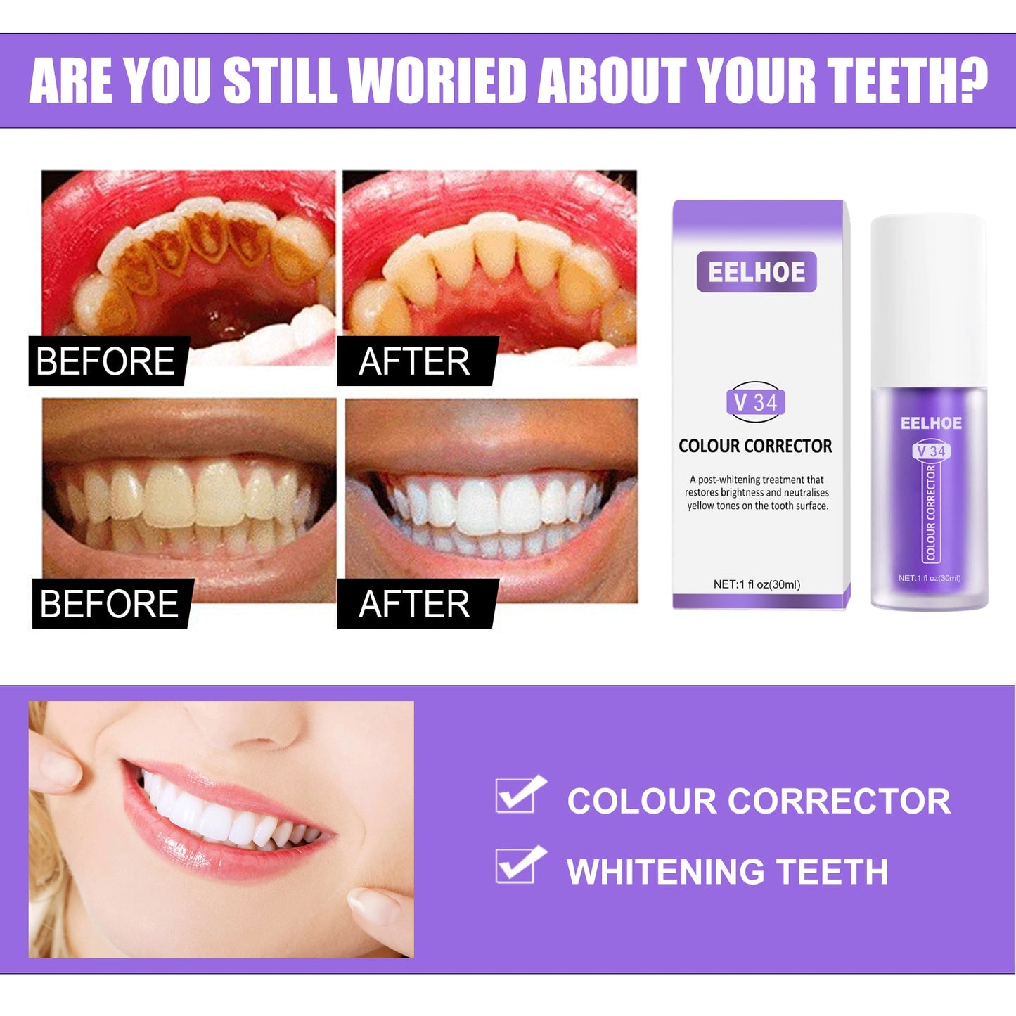 Dental Colour Corrector™