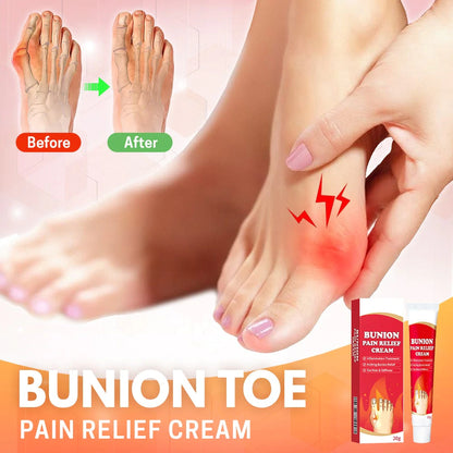 BUNNY™ Crema para el alivio del dedo del pie con juanetes