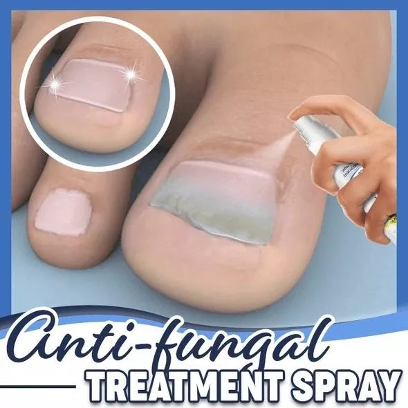 FUNGGY™ Anti-Fungal Treatment Spray