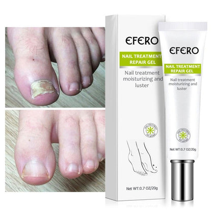 EFERO™ Nail Treatment