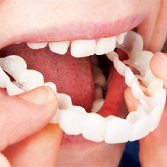 Alluream™️ Snap-On Dentures